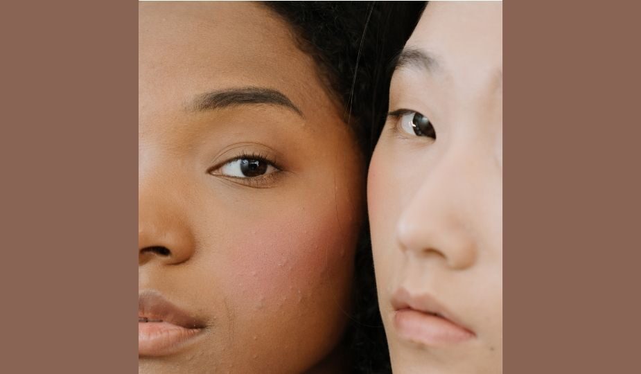 peau mixte africaine asiatique